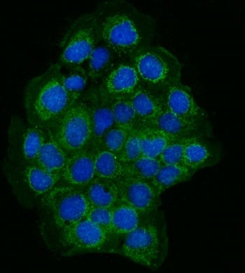 ZO-2 Antibody / Zonula occludens protein 2