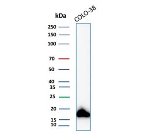 Western blot testing of human COLO-38 cell lysate with recombinant MART-1 antibody (clone MLANA/8108