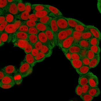 Immunofluorescent staining of permeabilized human MCF7 cells with CHP2 antibody (green) and Reddot n