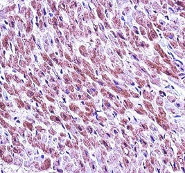 SMAD3 antibody immunohsitochemistry analysis in formalin fixed and paraffin embedded human heart tis