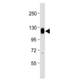 Western blot testing of Thrombomodulin antibody at 1:2000 + human THP1 cell lysate. Expected molecul