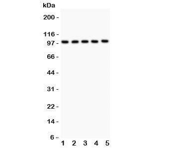 Western blot testing of HCN1 antibody and Lane 1: rat brain; 2: mouse brain; 3: human HeLa; 4: (h) U