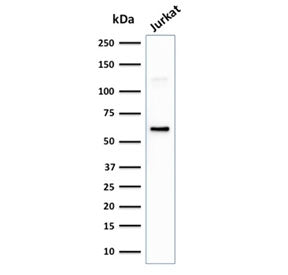 Western blot testing of human Jurkat cell lysate with CD63 antibody (clone LAMP3/2881). Predicted mo