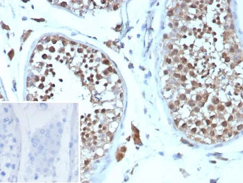 IHC staining of FFPE human testis tissue with recombinant Cyclin B1 antibody (clone CCNB1/9242R). In