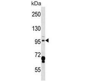 Western blot testing of mouse Neuro-2a cell lysate with Mekkk3 antibody. Predicted molecular weight