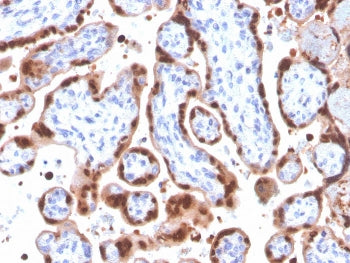 IHC staining of FFPE human placenta with HIF1 alpha antibody (clone Ha111a). HIER: boil tissue secti