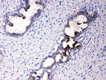 ATF6 Antibody