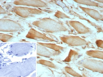 ZNF804A Antibody / Zinc finger protein 804A