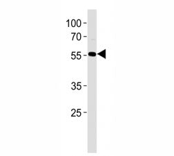 AKT antibody western blot analysis in HL-60 lysate