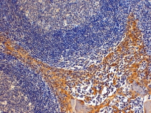 IHC testing of FFPE human tonsil with Importin 8 antibody at 4ug/ml. HIER: steamed with pH9 Tris/EDT
