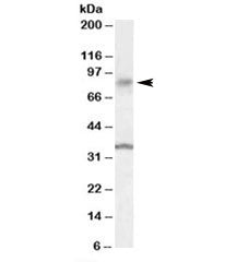 Western blot testing of human substantia nigra lysate with ANKK1 antibody at 0.1ug/ml. Predicted mol