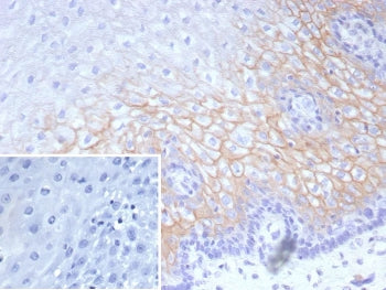 Desmocollin 2/3 Antibody