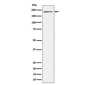 Western blot testing of human 293T cell lysate with MEKK4 antibody. Predicted molecular weight: 177-