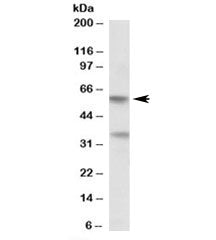 Western blot testing of human placenta lysate with SIGLEC6 antibody at 0.5ug/ml. Predicted molecular