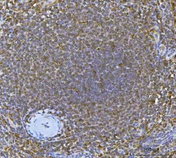 Interferon regulatory factor 7 Antibody / IRF7