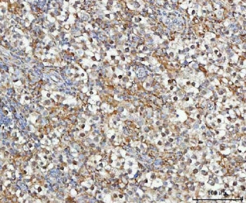 IHC staining of FFPE human testicular germ cell tumor tissue with MOSPD2 antibody. HIER: boil tissue