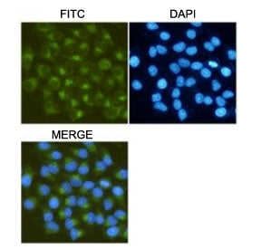ICC/IF testing of HeLa cells, fixed fixed by anhydrous methanol at -20oC, with MMP2 antibody at 1:50