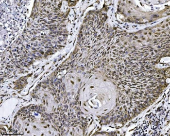 NDFIP2 Antibody / NEDD4 family-interacting protein 2