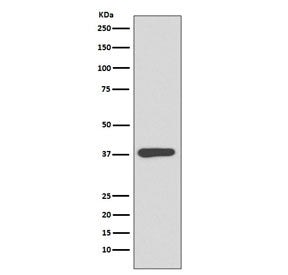 Maltose Binding Protein Antibody / malE / MBP tag