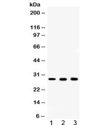 Western blot testing of 1) rat ovary, 2) mouse liver and 3) human MCF7 lysate with CA2 antibody at 0