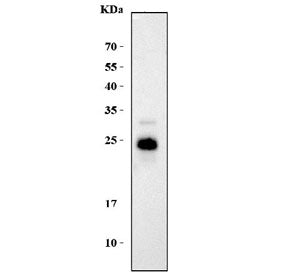 Western blot testing of mouse brain tissue lysate with DNAJC5 antibody. Predicted molecular weight ~