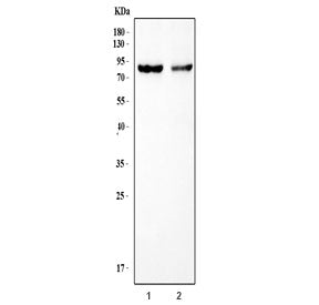 Western blot testing of 1) rat heart and 2) mouse heart tissue lysate with TEM8 antibody. Expected m