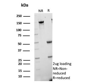 SDS-PAGE analysis of purified, BSA-free CETN1 antibody (clone CETN1/9878) as confirmation of integri