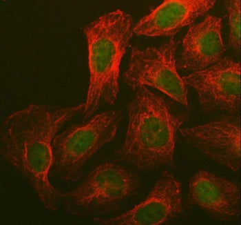BRCA1 Antibody (Breast Marker)