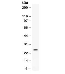 Western blot testing of mouse liver lysate with Apolipoprotein A I antibody. Predicted molecular wei