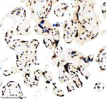 IHC analysis of Histone H3 (acetyl K14) using anti-Histone H3 (acetyl K14) antibody. Histone H3 (ace