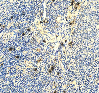 Immunohistochemical staining of RNF111 using anti-RNF111 antibody. RNF111 was detected in a paraffin
