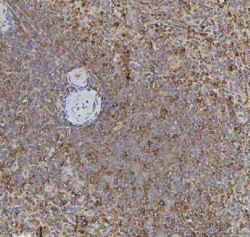 IHC staining of FFPE human spleen tissue with XCR1 antibody. HIER: boil tissue sections in pH8 EDTA