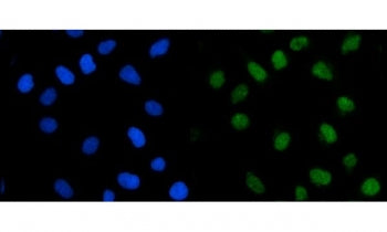 TRMT1 Antibody