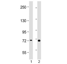 Western blot testing of human 1) placenta and 2) Jurkat lysate with TAP2 antibody at 1:2000. Predict