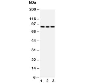 PI3K Antibody (p85 beta)