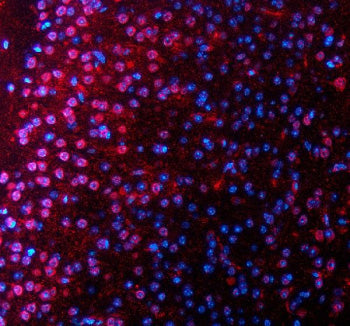 Immunofluorescent staining of SALL2 using anti-SALL2 antibody (red). SALL2 was detected in a paraffi