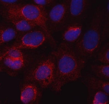 Immunofluorescent staining of FFPE human U-2 OS cells with Nitric Oxide Synthase 3 antibody (red) an