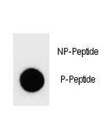 PTEN Antibody (phospho-Y68)