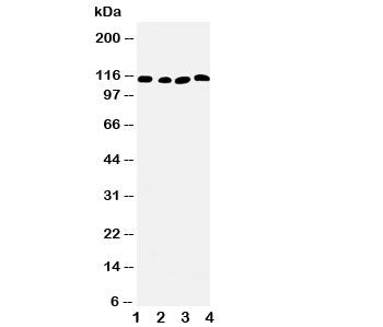 SERCA2 ATPase Antibody