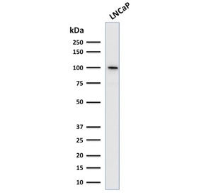 Western blot testing of human LNCaP cell lysate with Folate Hydrolase 1 antibody. Predicted molecula