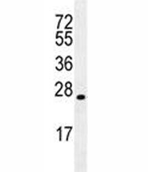 LIN28 Antibody