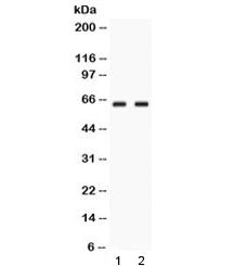 GPI Antibody / Glucose-6-phosphate isomerase