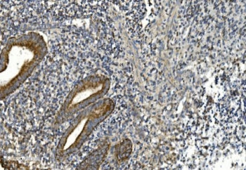 NOX2 Antibody / gp91phox