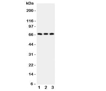 CD30 Antibody