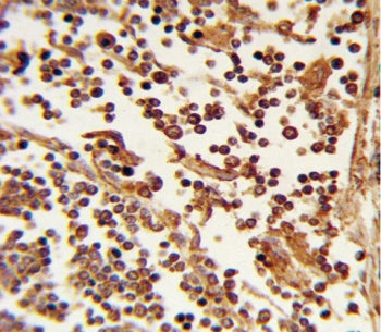 IHC staining of FFPE human lymph tissue with SELL antibody. HIER: steam section in pH6 citrate buffe