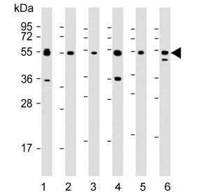 Western blot testing of 1) monkey COS-7 and human 2) Daudi, 3) HepG2, 4) HT-29, 5) Jurkat and 6) MCF