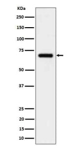 Western blot analysis of CD125/IL5RA in human serum cell lysate using IL5RA antibody. Predicted mole