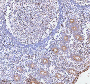 Immunohistochemical staining of HERPUD1 using anti-HERPUD1 antibody. HERPUD1 was detected in a paraf