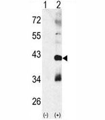 Western blot analysis of MAPK11 antibody and 293 cell lysate (2 ug/lane) either nontransfected (Lane