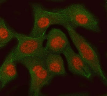 Immunofluorescent staining of FFPE human PC-3 cells with RFC3 antibody (red) and Alpha Tubulin mAb (